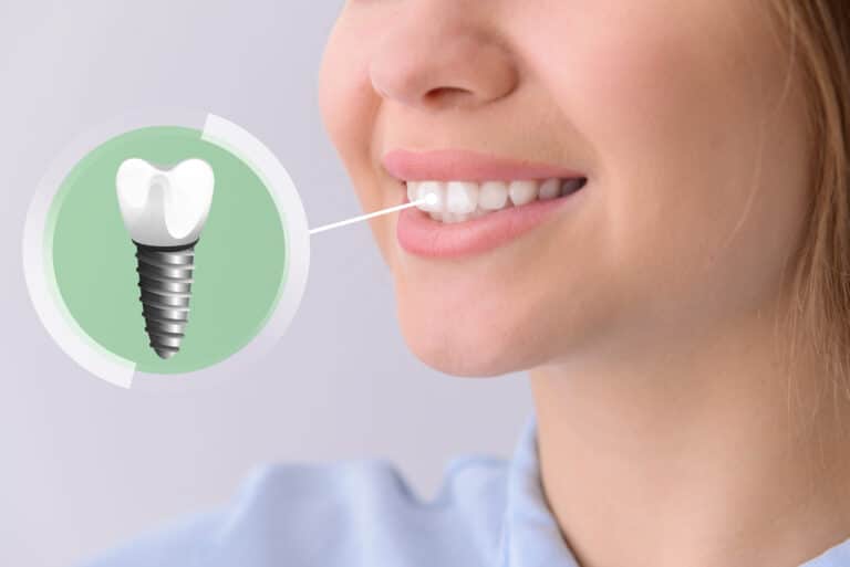 leesburg dental implants Dr. Zack Mekouar. Russell Branch Dental. Veneers, Teeth Whitening Traditional Braces (Metal and Ceramic), Invisalign, Root Canals, Wisdom Teeth Removal, Emergency Dental Services in Leesburg, VA 20175